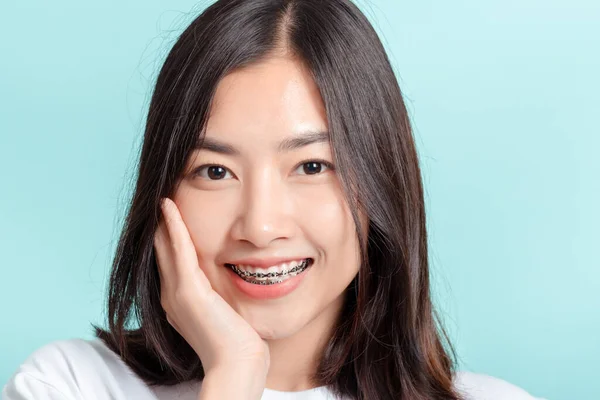 Dental Braces Young Asian Woman Wearing Braces Beauty Smile White — Stock Photo, Image