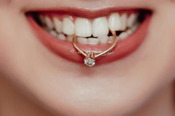 Feche Jovem Noiva Mostrando Sua Aliança Segurando Dentes Sorrindo Mulher — Fotografia de Stock