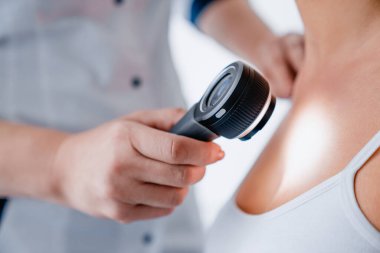 Kadın doktorun klinikte dermatoskoplu bir kızın cildini kontrol etmesi.