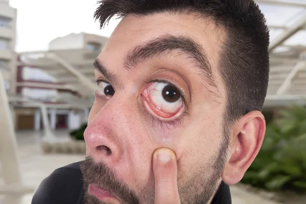 Caucasian Man Struggle Showing His Big Eye Camera — 스톡 사진
