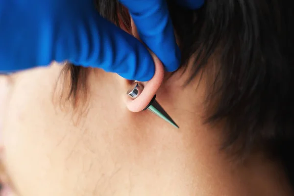 Stretching öron för större diameter tunnlar, piercer hand infogar piercing i örat — Stockfoto