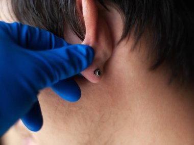 piercing and stretching the ears with medical  blue gloves. increase the diameter of the ear tunnels clipart