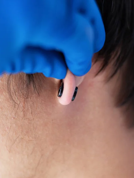 Piercing and stretching the ears with medical  blue gloves. increase the diameter of the ear tunnels — Stock Photo, Image