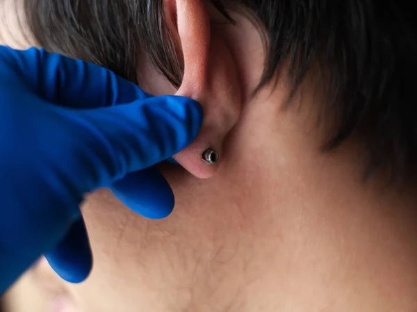 Piercing och stretching öronen med medicinska blå handskar. öka diametern på öron tunnlarna — Stockfoto
