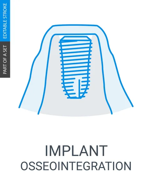 Implante dental Vector Icono . — Archivo Imágenes Vectoriales