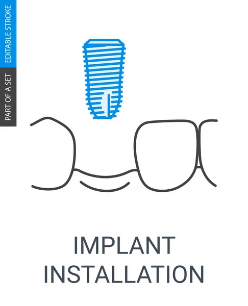 Yükleme simgesini implant — Stok Vektör