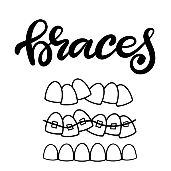 Ilustración de letras sobre el cuidado de la salud dental con la imagen de aparatos ortopédicos en los dientes. EPS10 — Vector de stock