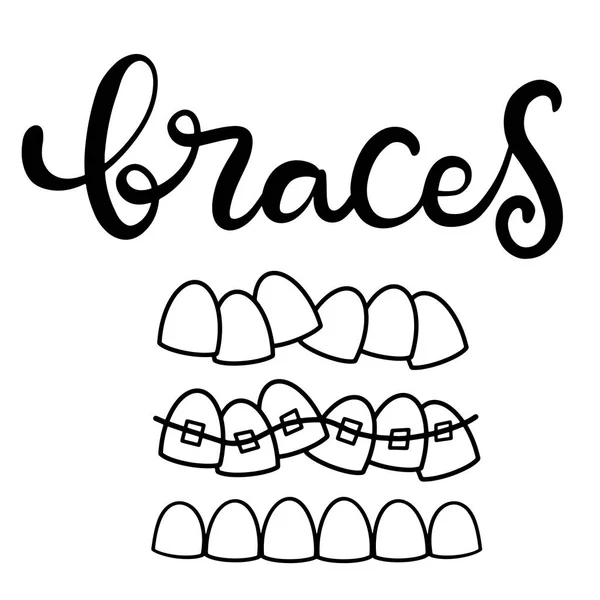Ilustración de letras sobre el cuidado de la salud dental con la imagen de aparatos ortopédicos en los dientes. EPS10 — Vector de stock
