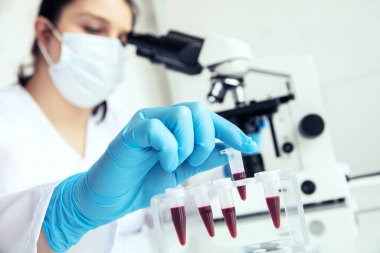 Tıbbi eldivenleri teslim et. Epindorf 'u kanla al. Kadın doktor, arka planda mikroskop ve insan kanı olan eppendorf test tüpü alır..