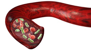 Ven ve kırmızı kan hücreleri bir virüs, bakteri içinde bir arter dolaşımını tarafından saldırıya uğradı. Escherichia coli. Bir damar bölümü. 3D render