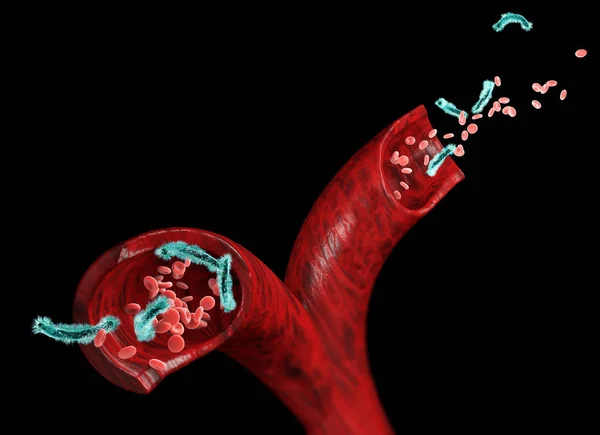 Venas Glóbulos Rojos Atacados Por Virus Circulación Bacterias Dentro Una — Foto de Stock