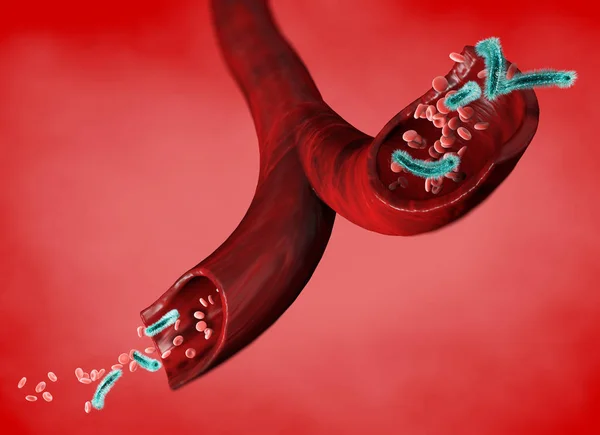 Véna Vörös Vérsejtek Által Megtámadva Vírus Baktériumok Egy Artéria Áramlását — Stock Fotó