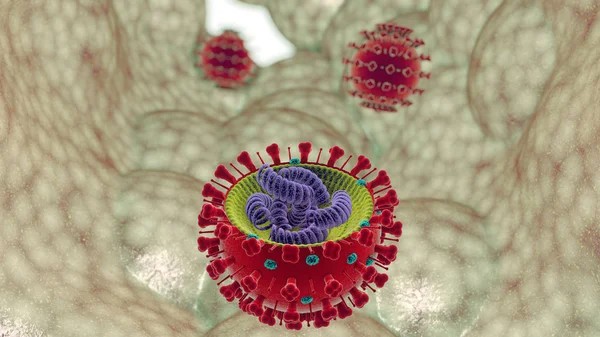 Influenza Vírus Influenza Egy Influenza Vírus Által Okozott Fertőző Megbetegedés — Stock Fotó