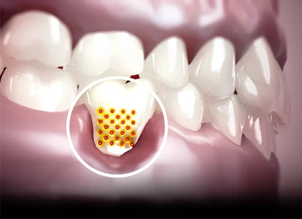 Jamy Ustnej Zębów Dziąseł Wrażliwe Zęby Wycofanie Dziąsła Wrażliwość Zębów — Zdjęcie stockowe