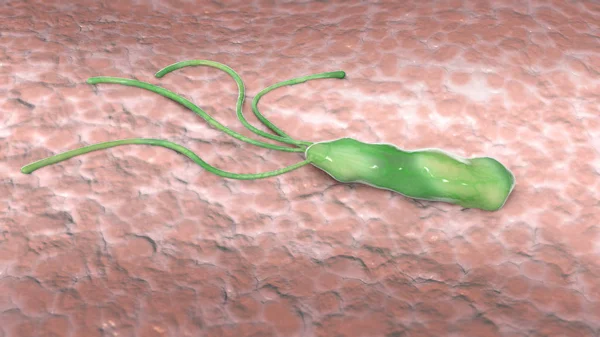Helicobacter pylori is a microaerophilic bacterium usually found in the stomach. It is present in a person with chronic gastritis and gastric ulcers. Bacterium seen under a microscope. 3d rendering