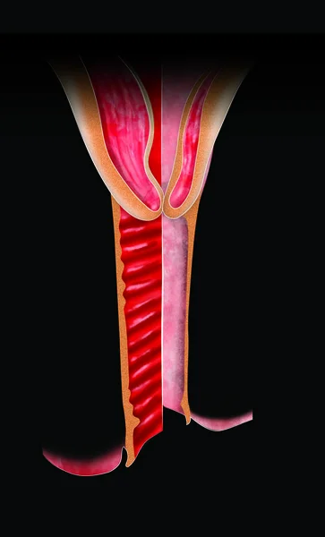 萎縮性膣炎は 膣組織の十分なエストロゲンによる間伐の結果としての炎症です 閉経後膣上皮は変更され いくつかの層の厚さになります 泌尿生殖器症状します — ストック写真
