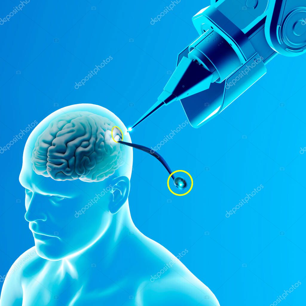 neuralink #hashtag