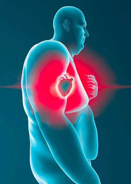 Şişman Adam Kalp Krizi Yerde Yatan Bir Adam Kalp Rahatsızlığı — Stok fotoğraf