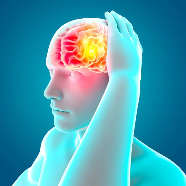 Douleurs Dans Tête Cerveau Les Synapses Problèmes Cognitifs Déficit Mental — Photo