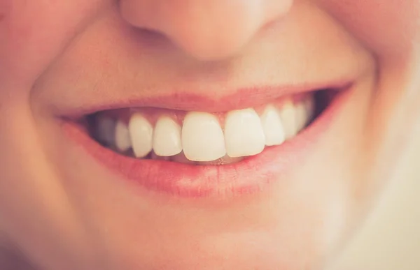 Fehér fogak egy boldog fiatal lány — Stock Fotó