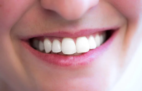 Dientes blancos de una joven feliz —  Fotos de Stock