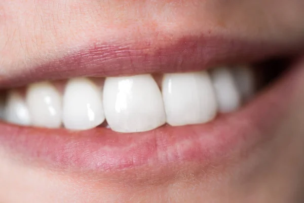 白い歯をした女性の口の近くに — ストック写真