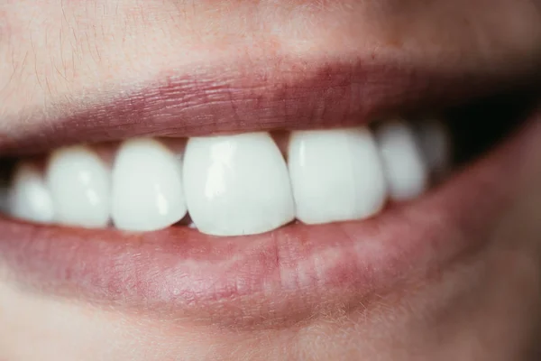 Cierre Boca Una Mujer Con Dientes Blancos — Foto de Stock