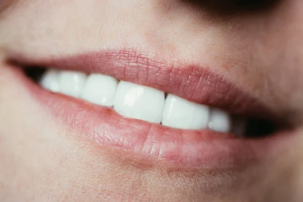 Κοντινό Πλάνο Του Στόματος Μιας Γυναίκας Λευκά Δόντια — Φωτογραφία Αρχείου