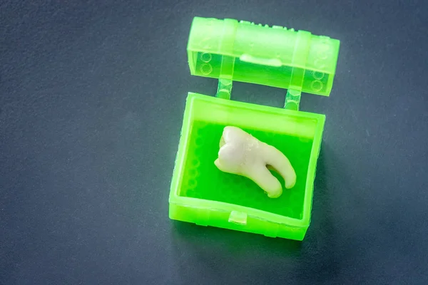 Model Zęba Pudełko Izolowane Tle — Zdjęcie stockowe