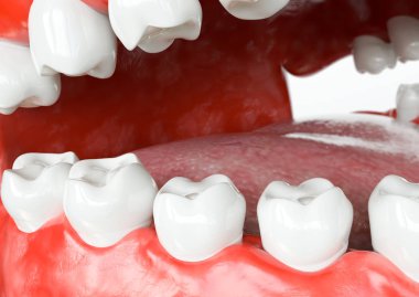 Sonra insan implant diş. Diş kavramı. İnsan diş ya da protez. 3D render