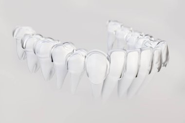 Görünmez aligner, diş teli--3d render