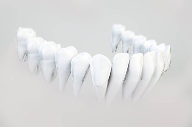 Görünmez aligner, diş teli--3d render