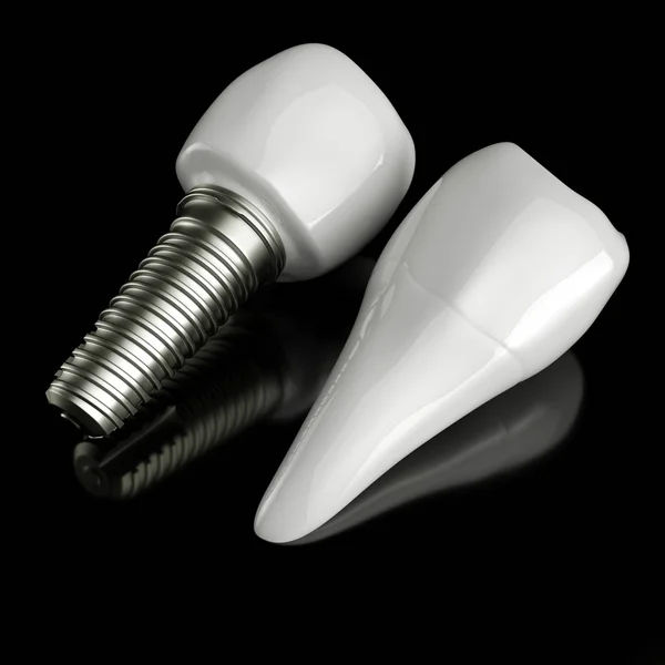 Zubní Implantát Rozebrán Vykreslování — Stock fotografie