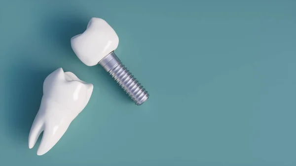 İnsan implant diş. Diş kavramı. İnsan diş ya da protez. 3D render