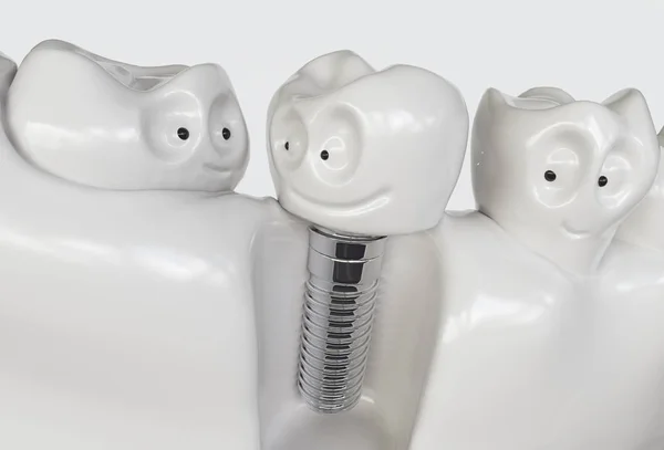 Tooth human cartoon implant. Dental concept. Human teeth or dentures. 3d rendering