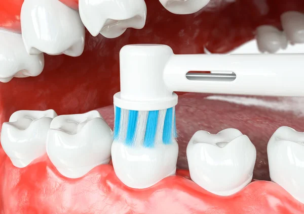 Limpieza Dental Superficies Oclusales Renderizado — Foto de Stock