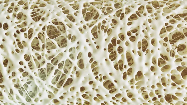 Osteoporosi Dettagli Avanzati Fase Rendering — Foto Stock