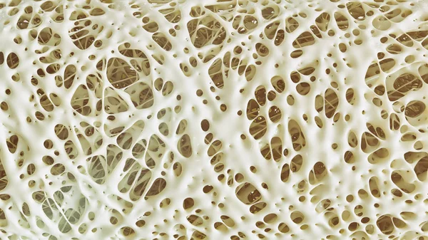 Osteoporose Detalhes Avançados Etapa Renderização — Fotografia de Stock