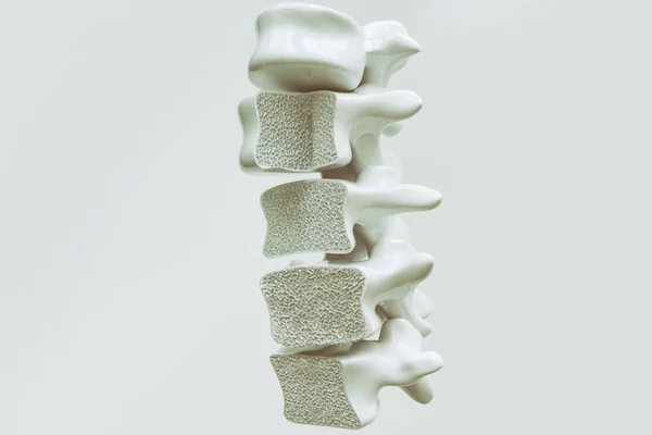 Osteoporosi Sulla Colonna Vertebrale Rendering — Foto Stock