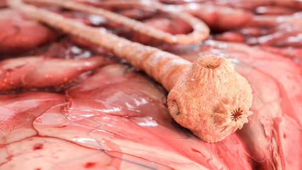 Varkensvlees Lintworm Detaild Taenia Solium Onder Microscoop Rendering — Stockfoto