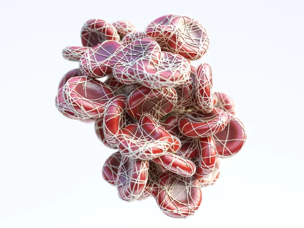 Closeup yüksek detayları - 3d render ile bir ateroskleroz