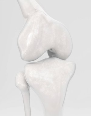 Modern diz protezsiz diz protezi -- 3B görüntüleme