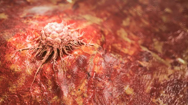Ακριβής Απεικόνιση Ενός Καρκινικού Κυττάρου Αποτύπωση — Φωτογραφία Αρχείου