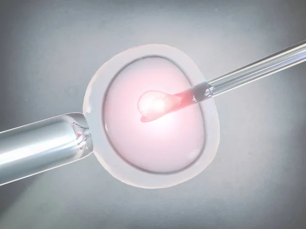 Vitro Fertilisation Rendu — Photo