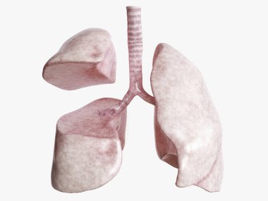 Lobectomy after severe lung disease - 3 of 4 - 3D Rendering clipart