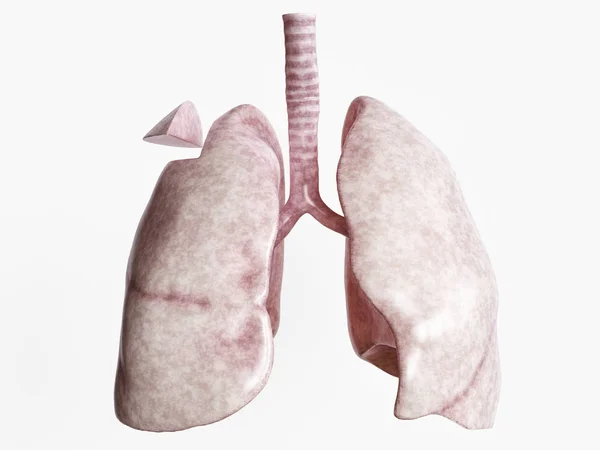 Resekcji Ciężką Chorobą Płuc Renderowania — Zdjęcie stockowe