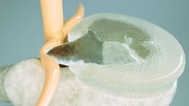Spinal disc herniation as close-up as 3D Rendering clipart