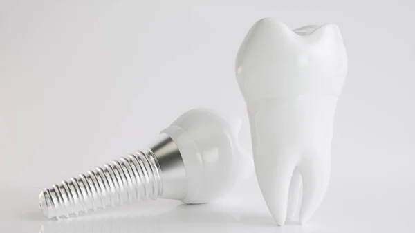 Implant w porównaniu do zdrowych zębów-renderowanie 3D — Zdjęcie stockowe