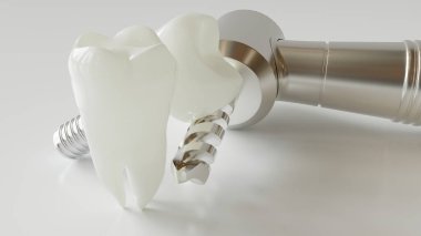 sağlıklı diş ve implant ile bir diş matkabı - 3 boyutlu oluşturma