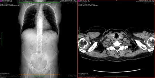 CT taraması kadın karın.